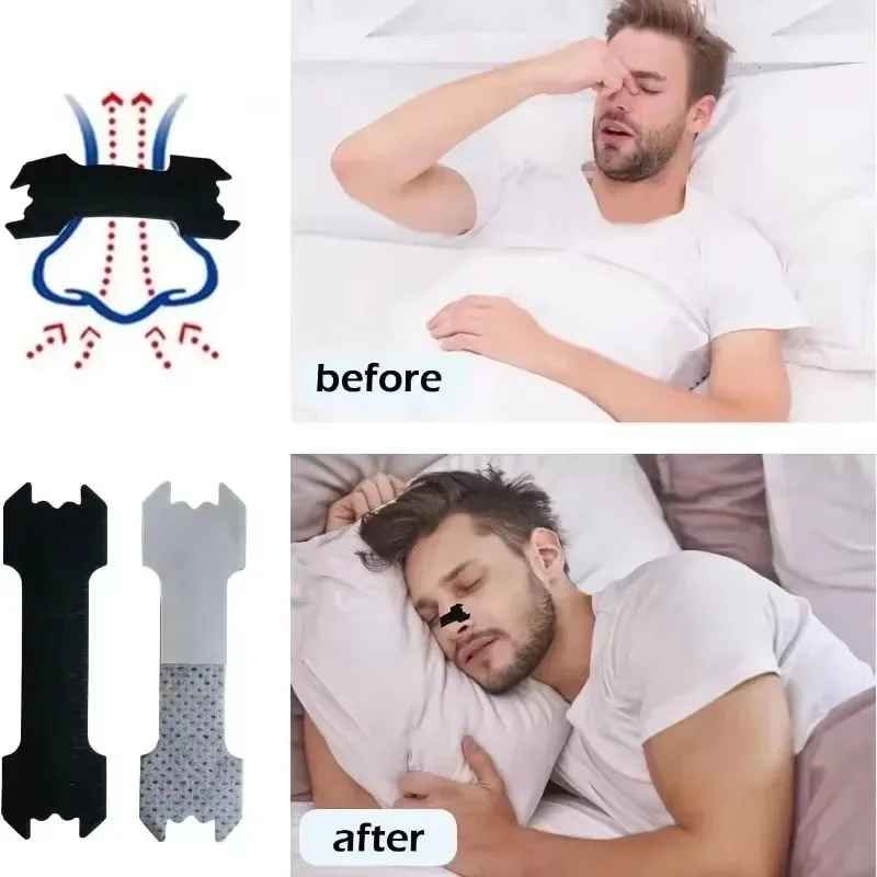 Anti Nose Snoring Patches